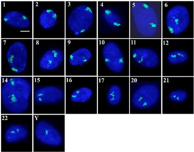 Interphase Chromosomes in Replicative Senescence: Chromosome Positioning as a Senescence Biomarker and the Lack of Nuclear Motor-Driven Chromosome Repositioning in Senescent Cells